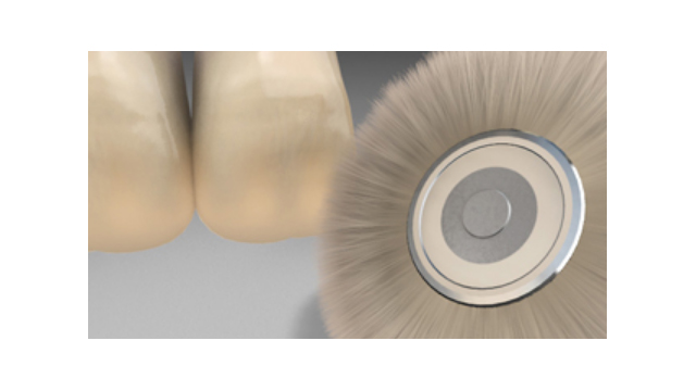 Compozite accesorii pentru fațetare