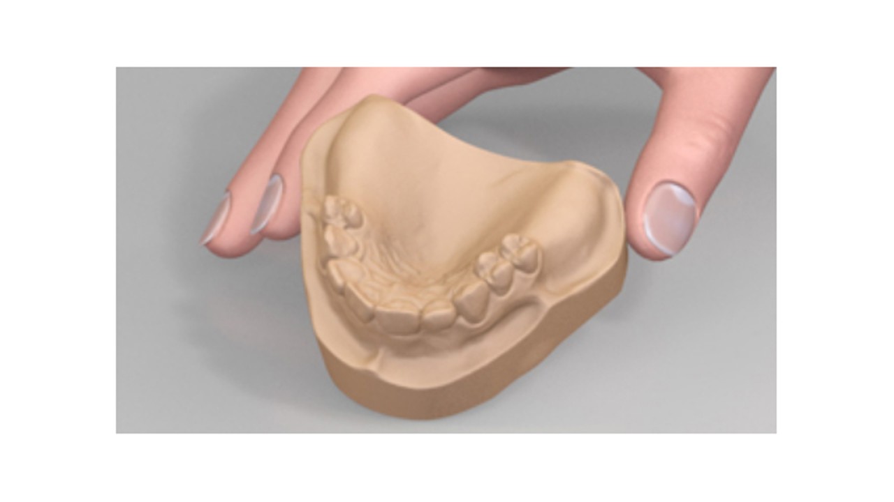 Gipsuri dentare clasa a III-a