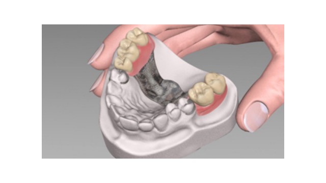 Materiale pentru protetică dentară