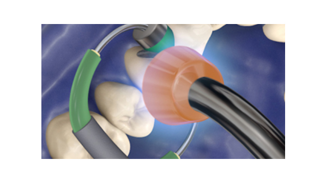 Lumini LED pentru polimerizare