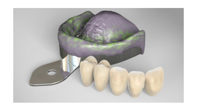 Materiale pentru protetică dentară