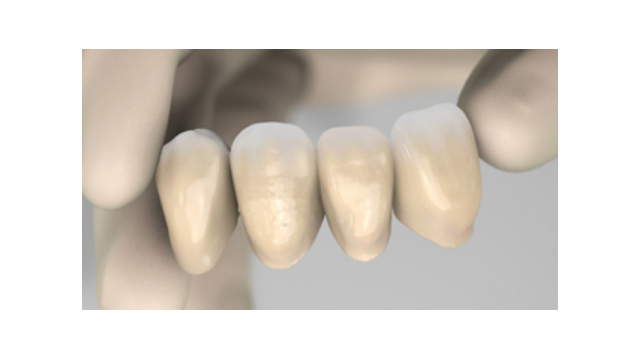 Materiale provizorii