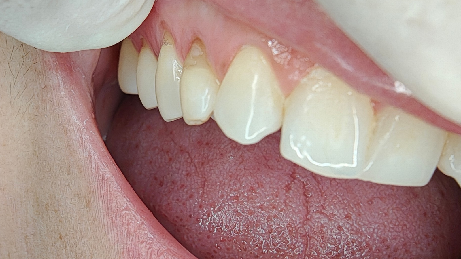 Click and hold the green slider. Move from side to side to reveal the before-and-after pictures.