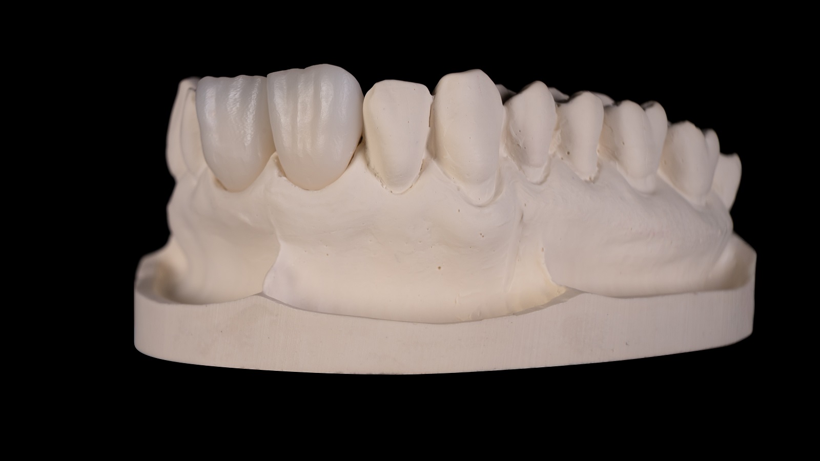 HeraCeram cre-active – conceptul „Bleach please”