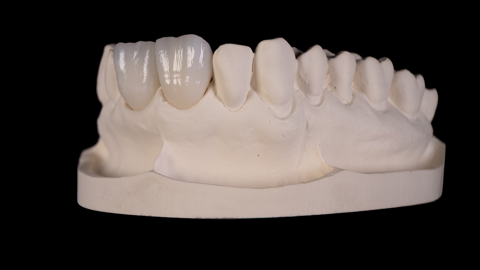 Rezultatul după arderea HeraCeram cre-active 2D