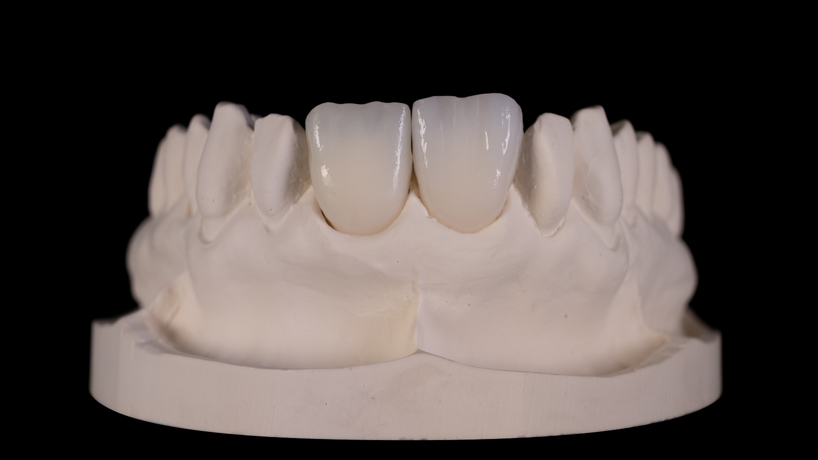 HeraCeram cre-active – conceptul „Bleach please”