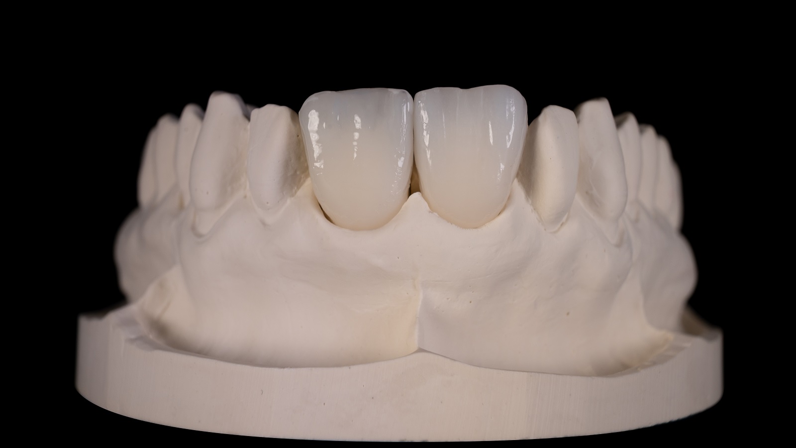 HeraCeram cre-active – conceptul „Bleach please”