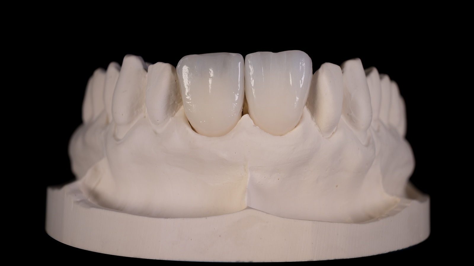 Rezultatul final după arderea HeraCeram cre-active 2D