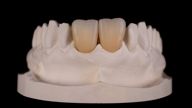 Zirconia multi-layer frames in A3 - ready for individualisation