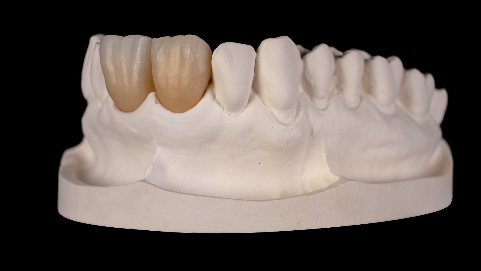 HeraCeram cre-active - Magic matrix concept