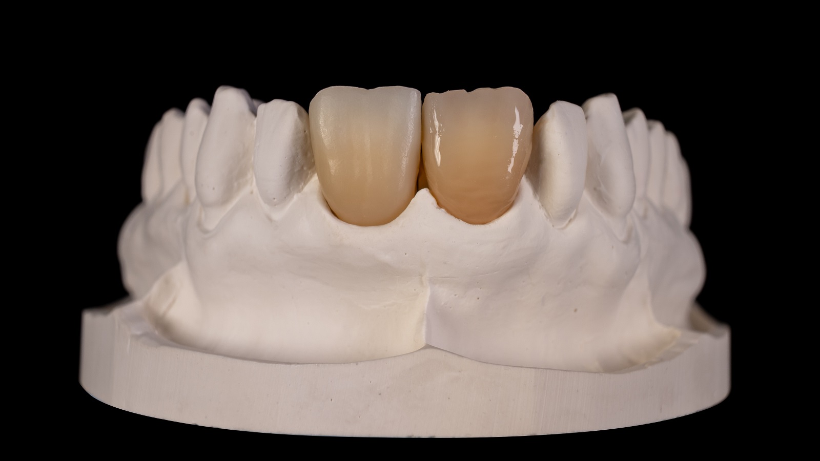 Aplicarea unui strat subțire de HeraCeram cre-active Glaze Fluo pe întreaga suprafață