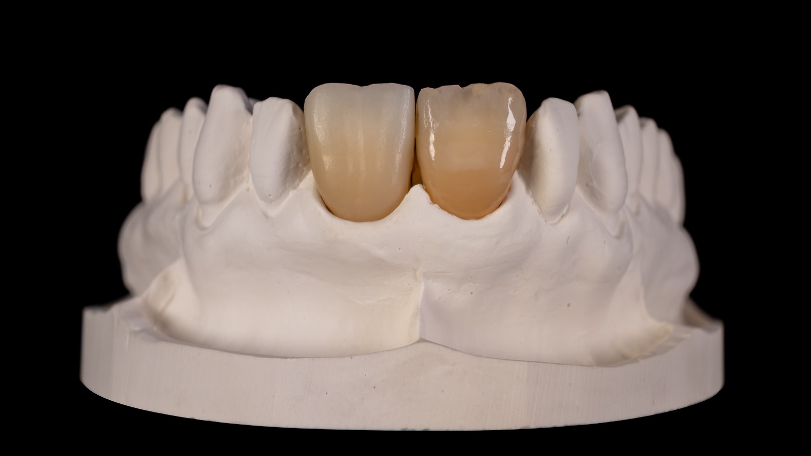 Rezultatul după arderea HeraCeram cre-active 2D
