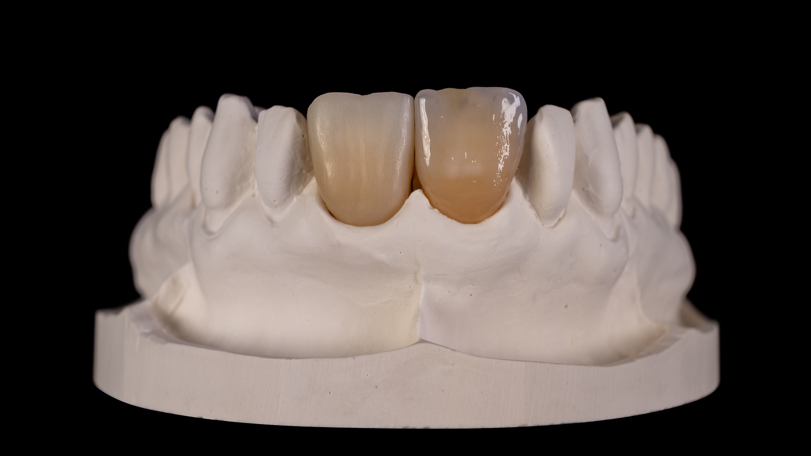Rezultatul după arderea HeraCeram cre-active 3D