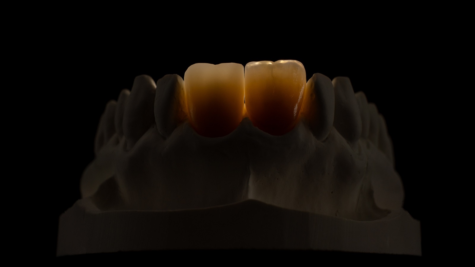 In transmitted light.