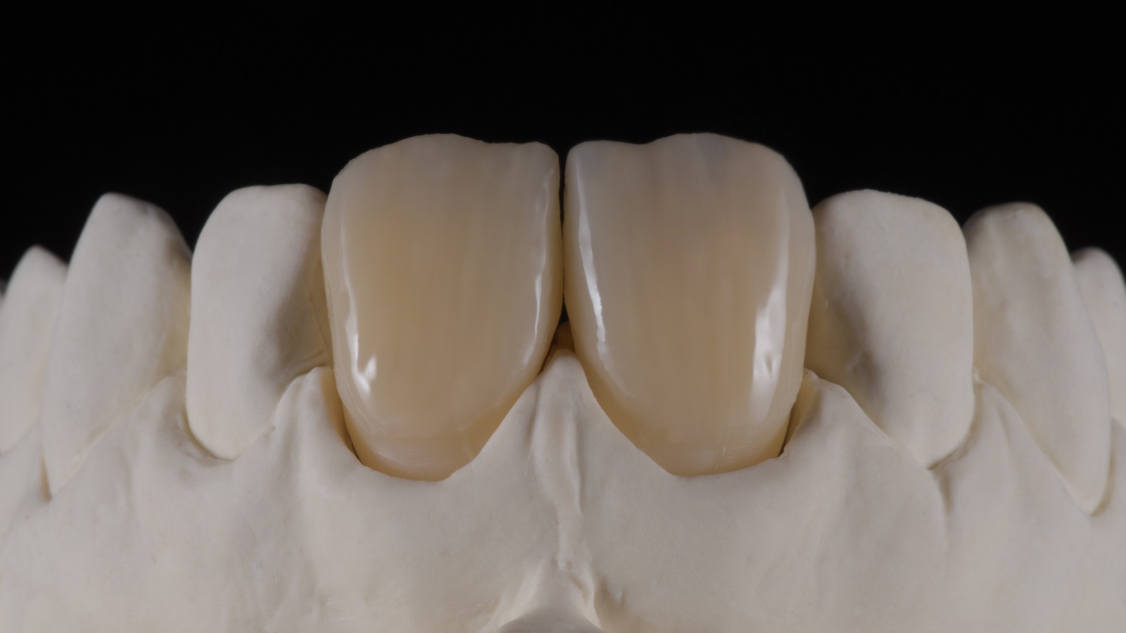 HeraCeram cre-active – conceptul „Take two”