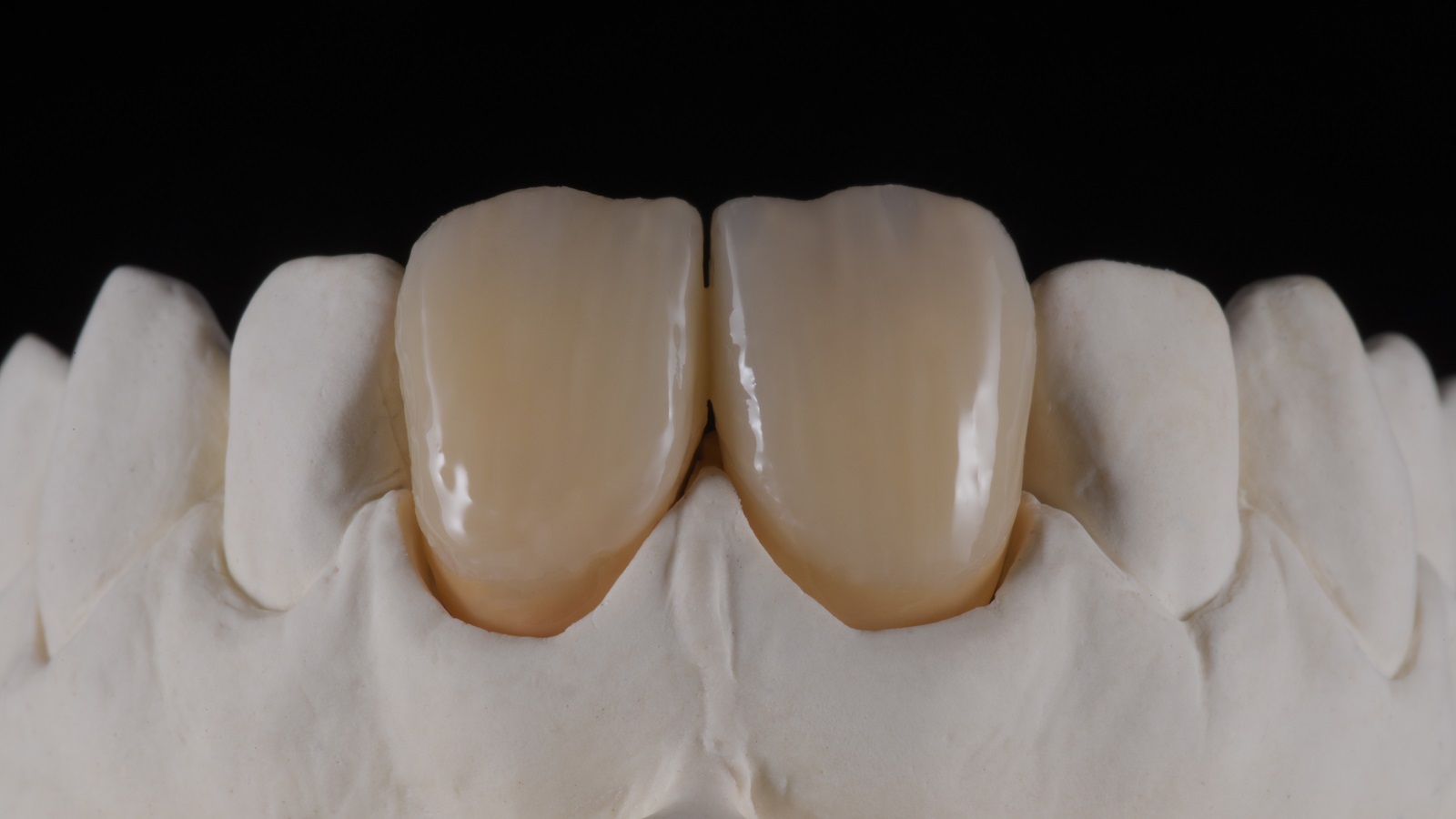 HeraCeram cre-active – conceptul „Take two”