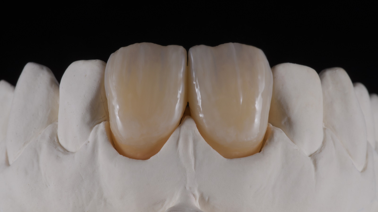 HeraCeram cre-active – conceptul „Take two”