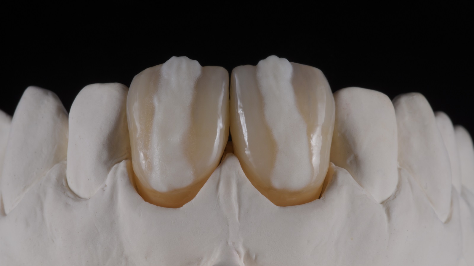 HeraCeram cre-active – conceptul „Take two”