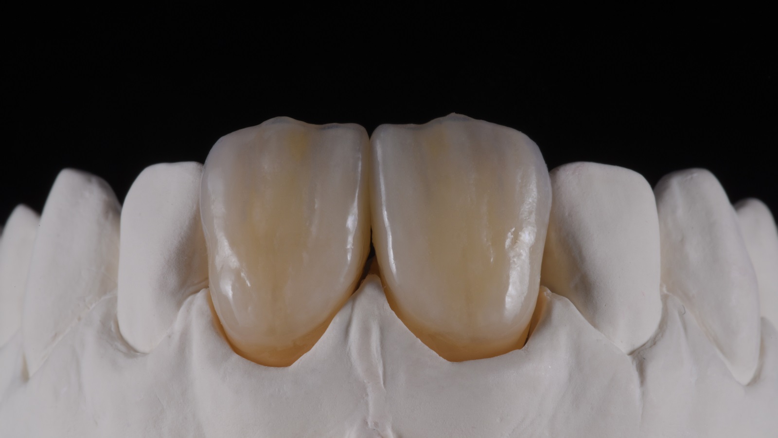 HeraCeram cre-active – conceptul „Take two”