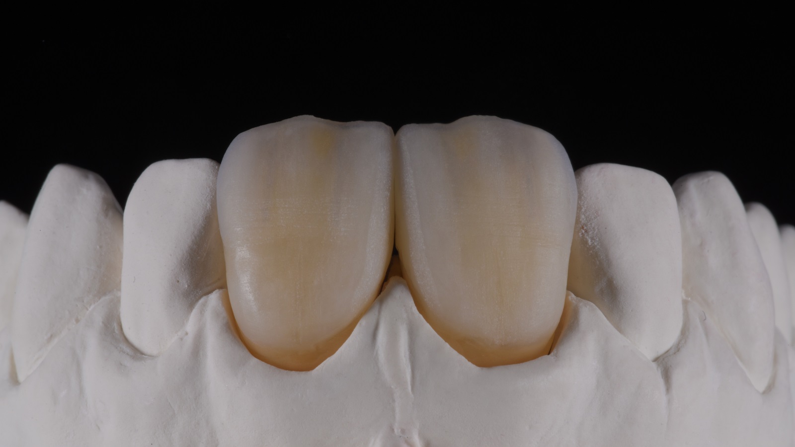 HeraCeram cre-active – conceptul „Take two”