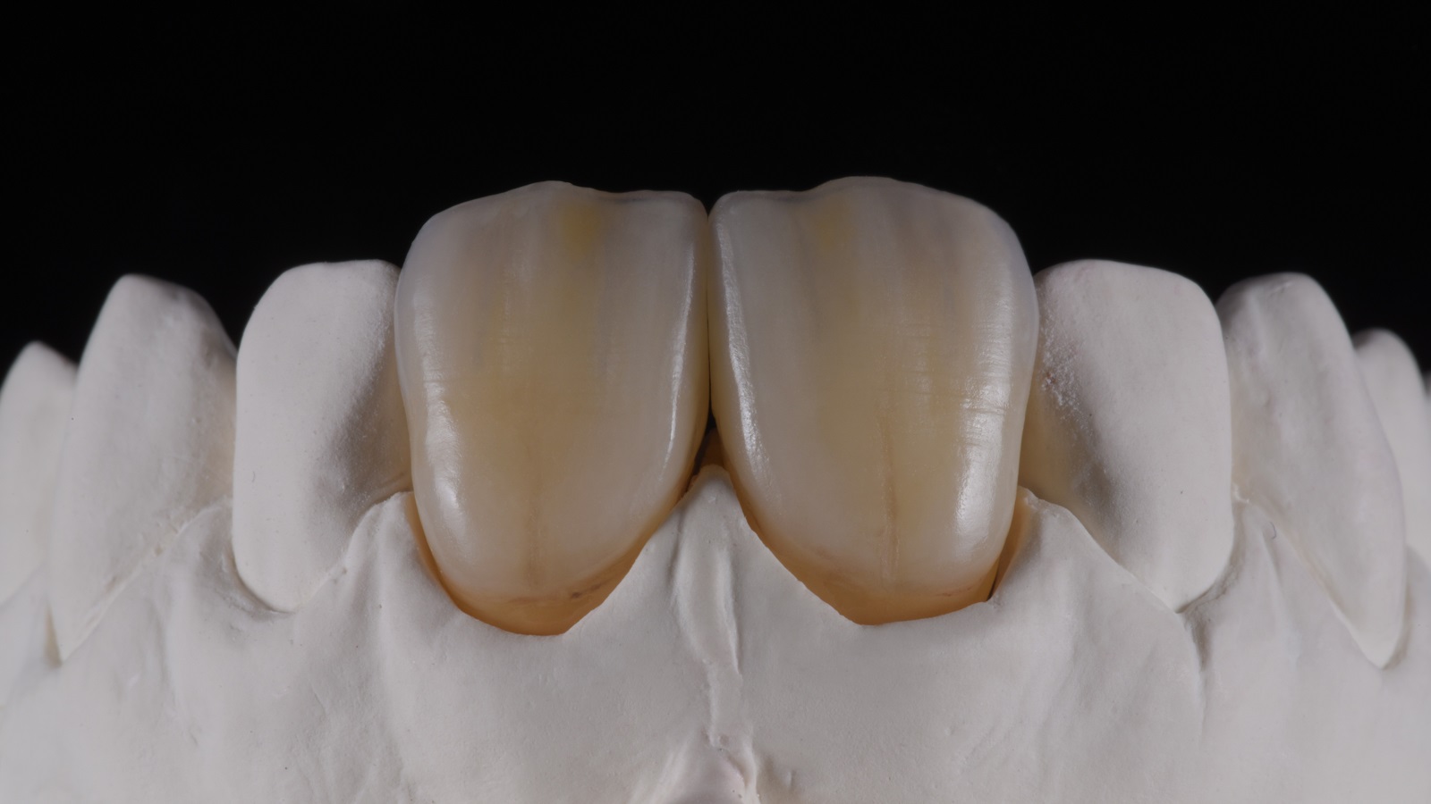 HeraCeram cre-active – conceptul „Take two”