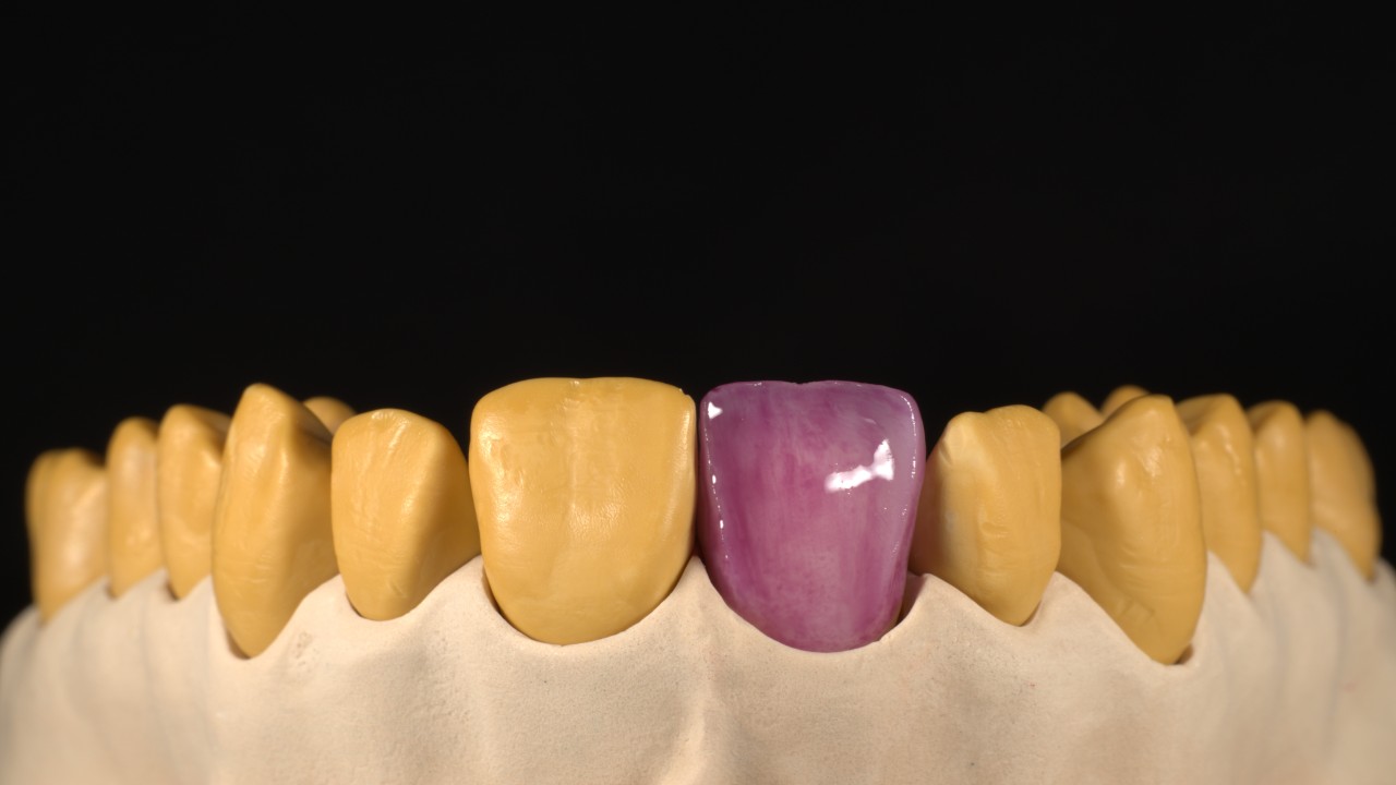 Image 2 Adhesive application 