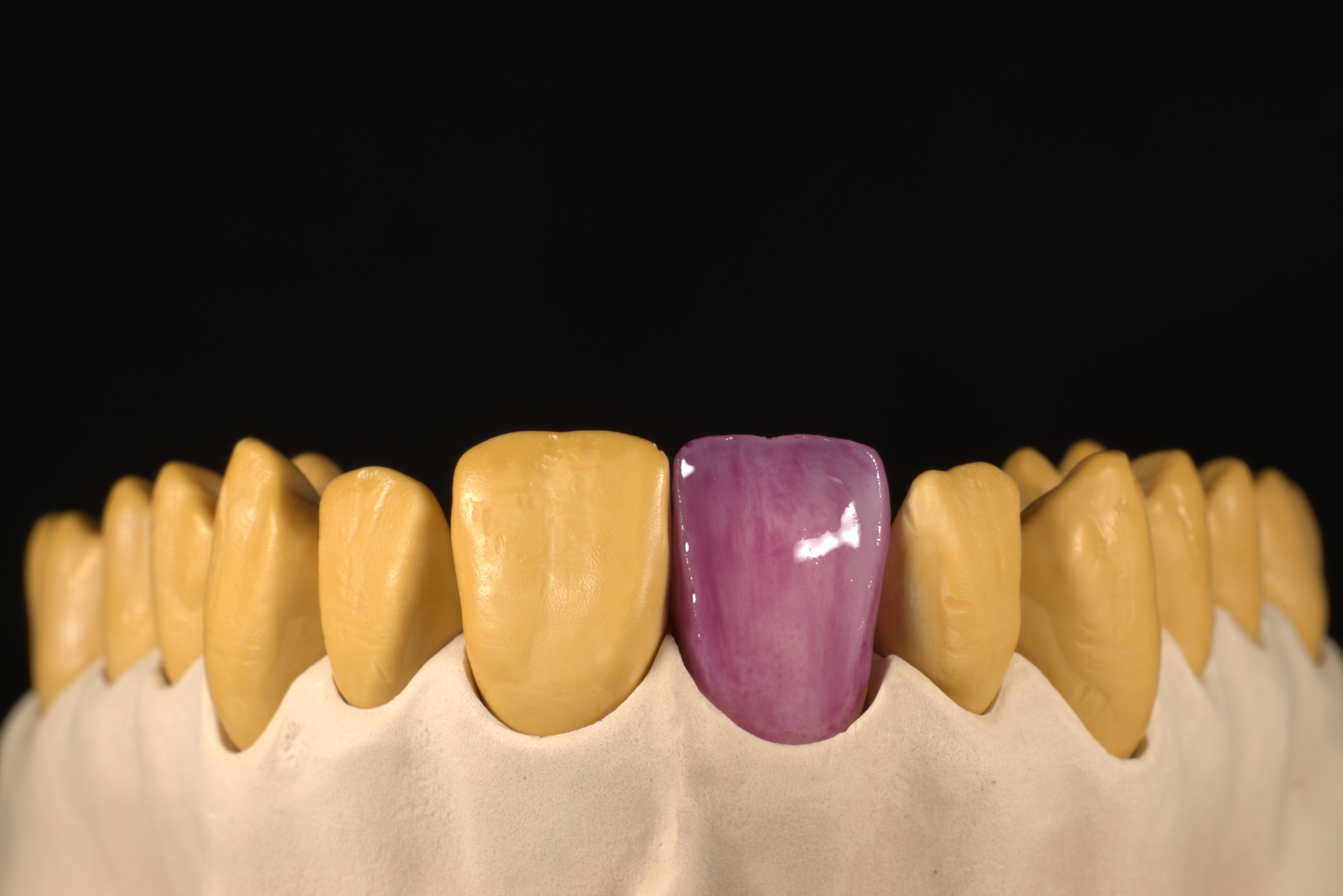 Image 2 Adhesive application 