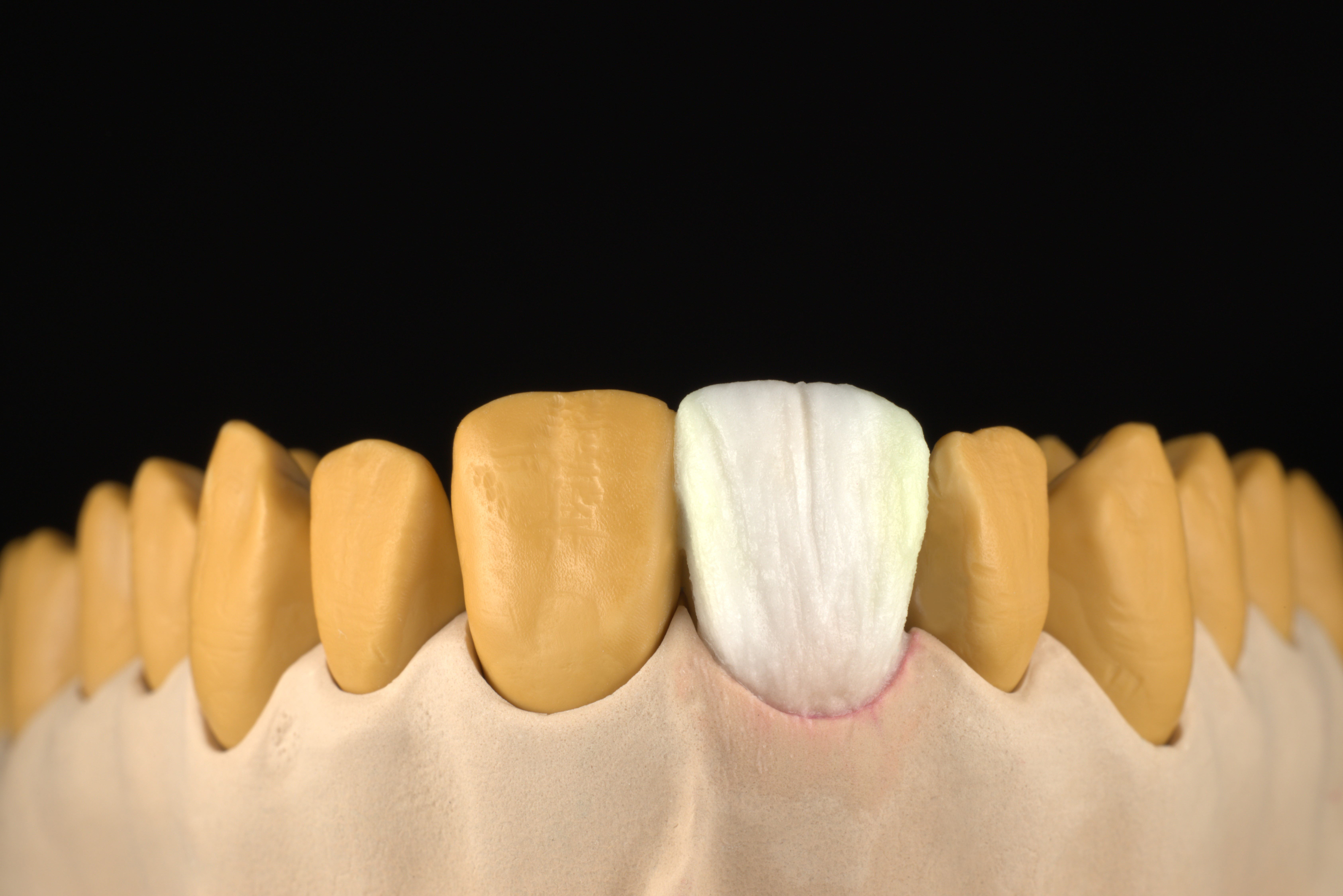 Image 6: Final shaping and shade detailing