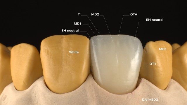 Image 7: Firing and glazing. 